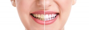 woman-teeth-and-smile-close-u-38719831